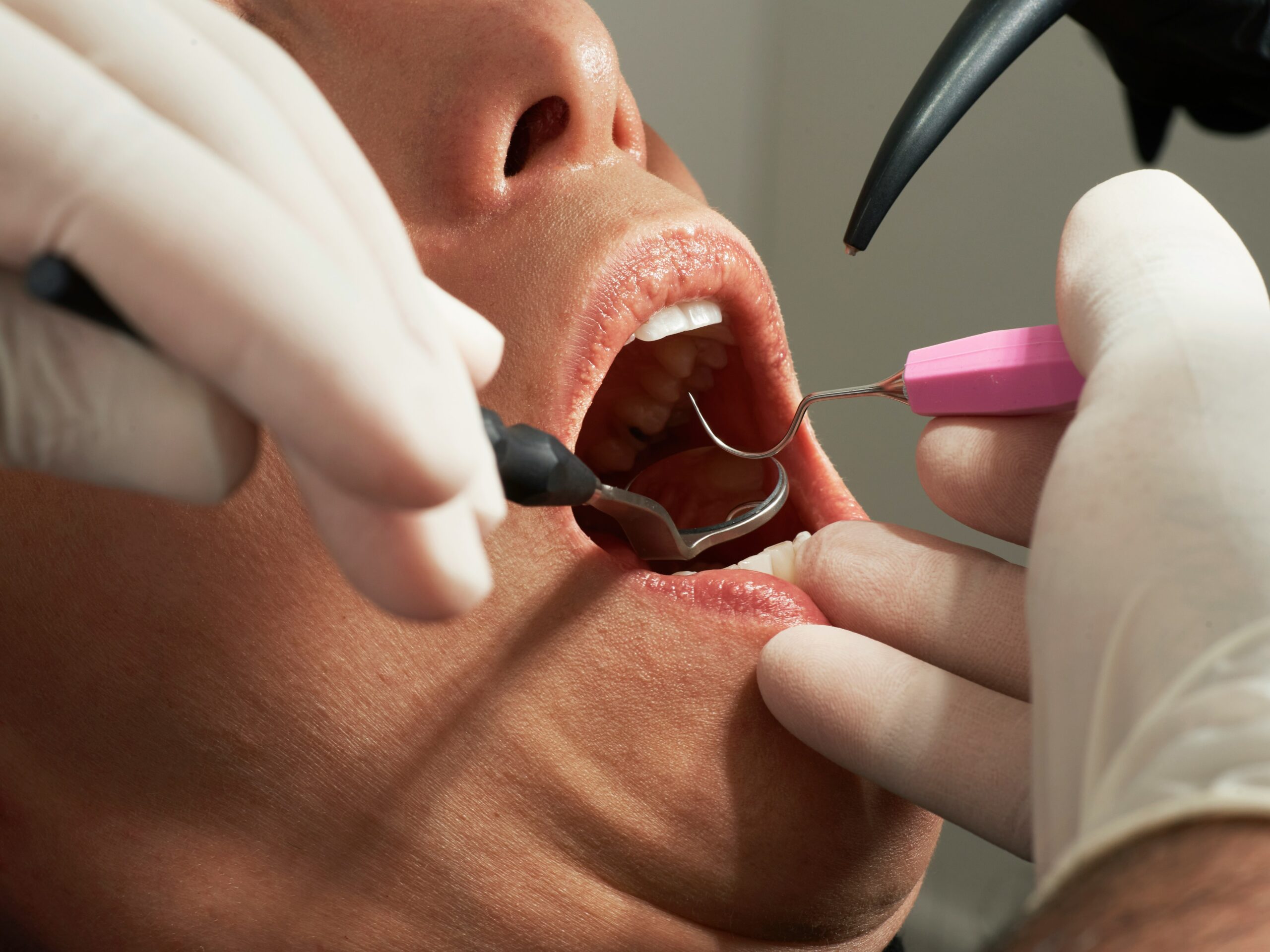 wallentine law you need jerry dental malpractice